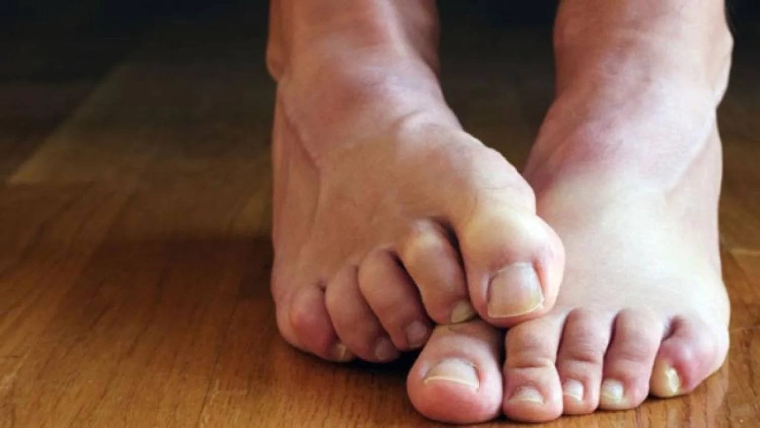 7 marks on the feet.. Indicators of serious health problems