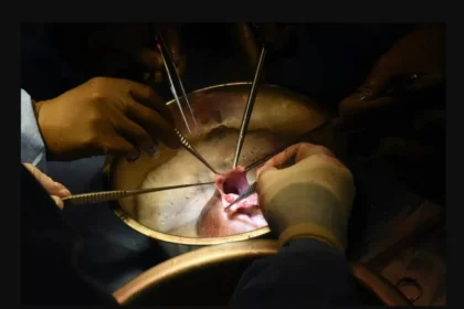 "خطوة ثورية".. زراعة رئة خنزير في جسد إنسان