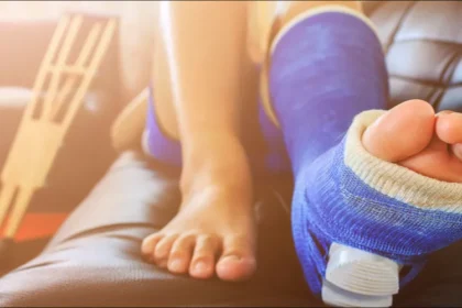 هل تصدق؟!.. إطالة الساقين تبدأ بـ "تكسير العظام" 