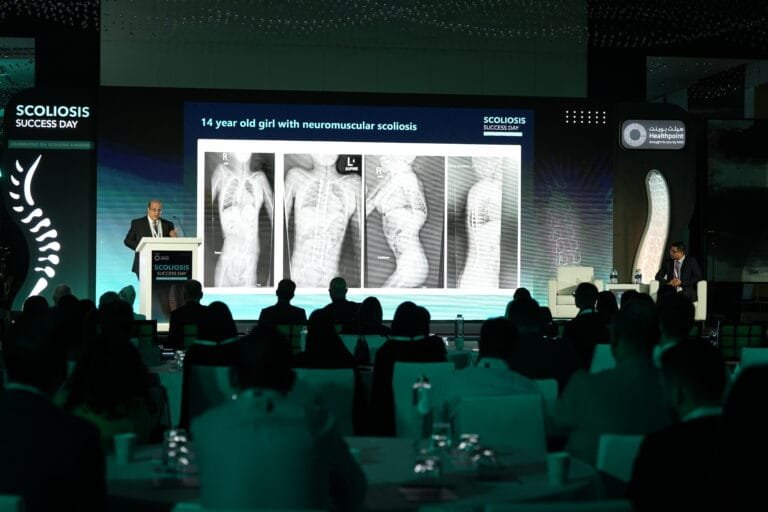 Healthpoint Hospital Celebrates Over 70 Successful Scoliosis Surgeries in Abu Dhabi