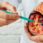 Goodbye to "kidney stones". A promising treatment may end this torment