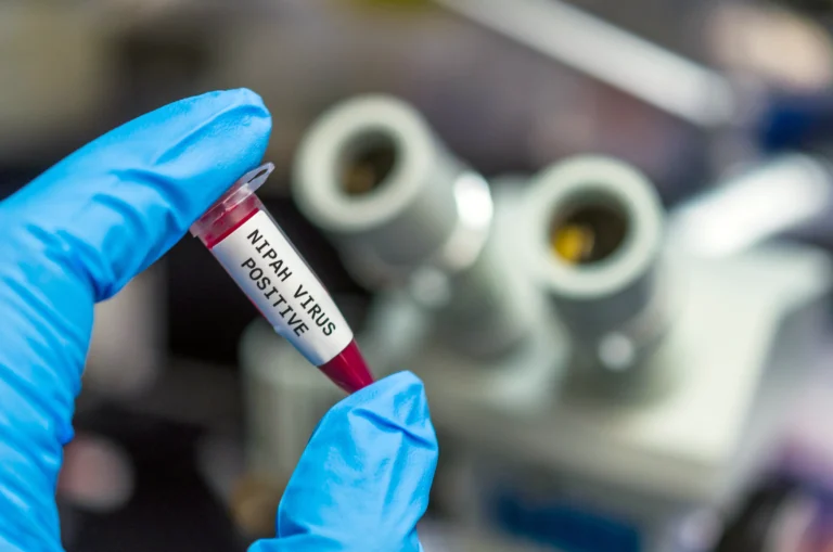 The specter of "Nipah" haunts Asia... A deadly virus that kills 75% of those infected puts airports on high alert