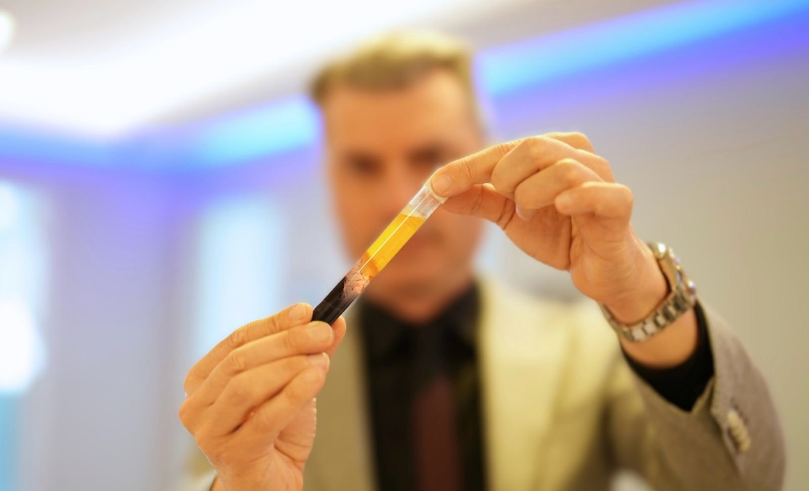 Russian scientific discovery: A protein lined to diabetes may pave the way for a treatment for Parkinson’s disease