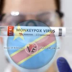 الكونغو الديمقراطية تعلن انتهاء تفشي جدري القرود بعد عامين