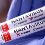 41 people are under medical observation in the United States due to the Hantavirus