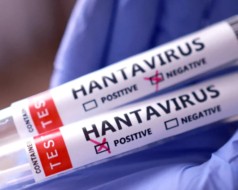 41 people are under medical observation in the United States due to the Hantavirus