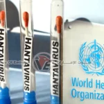 الصحة العالمية تفشي فيروس هانتا لا يمثل بداية جائحة عالمية