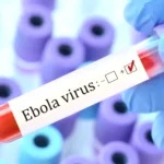 شفاء مريض أمريكي من فيروس إيبولا بعد تلقيه العلاج في ألمانيا