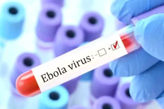 شفاء مريض أمريكي من فيروس إيبولا بعد تلقيه العلاج في ألمانيا