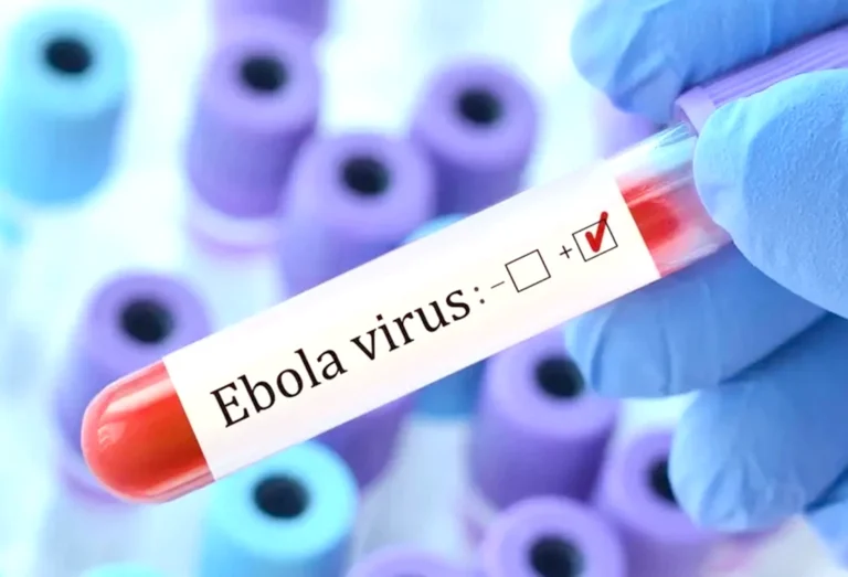 شفاء مريض أمريكي من فيروس إيبولا بعد تلقيه العلاج في ألمانيا